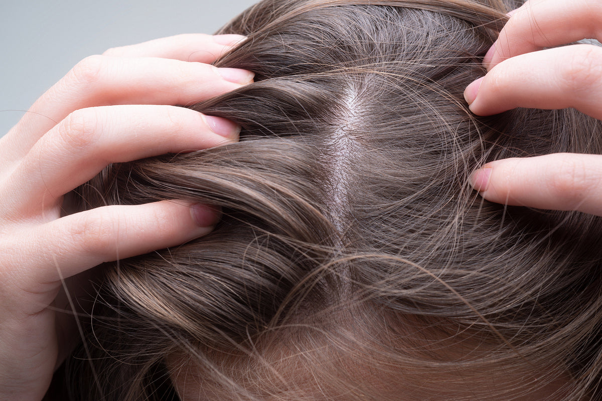 Scalp Psoriasis Treatment (12 count)