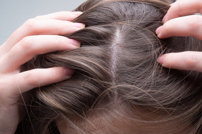 Scalp Psoriasis Treatment (12 count)